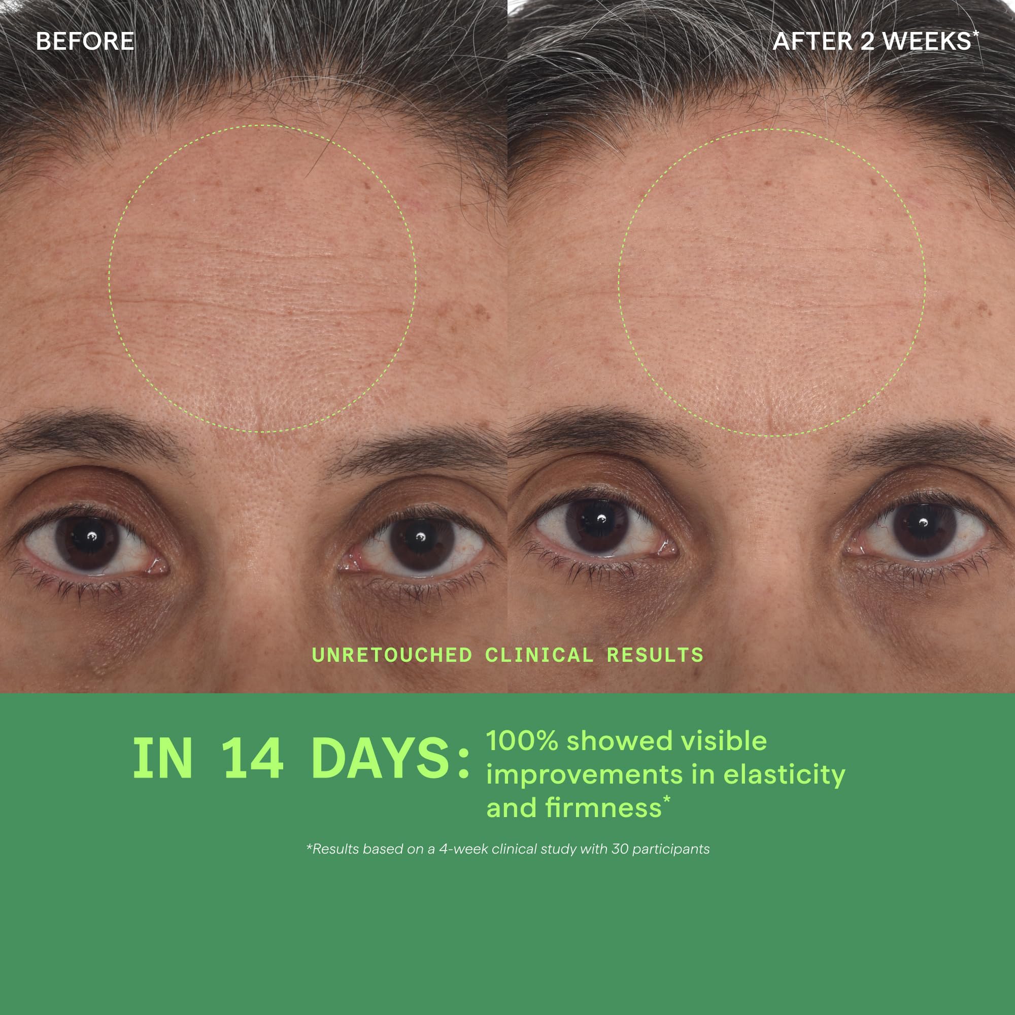 Murad hyaluronic acid concept image showing multi-depth hydration boost