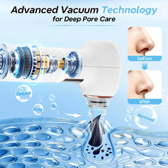 Mylzdobs five interchangeable probes displayed for targeted blackhead removal benefits