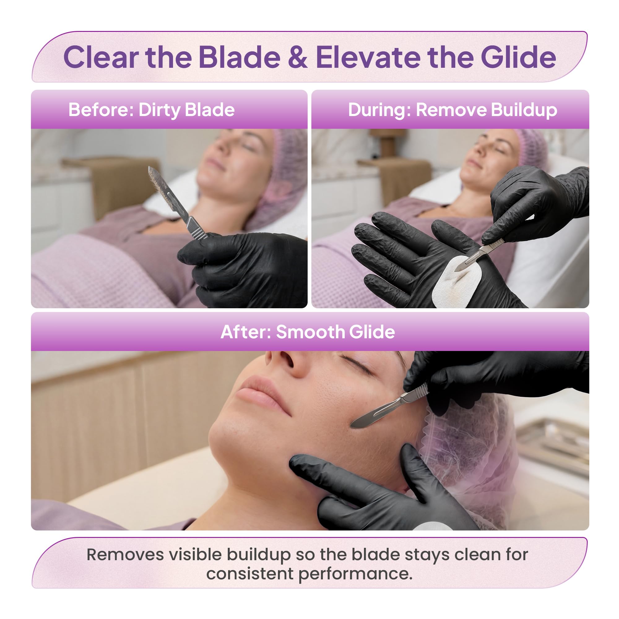 MyMed close-up micro-texture captures debris for cleaner blades benefit