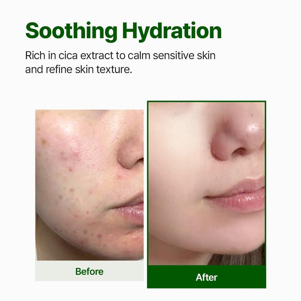 NACIFIC clear toner droplet on fingertip showing lightweight hydrating texture