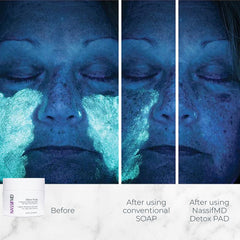 NassifMD single pad close-up showing soft texture and ready-to-use exfoliation benefit