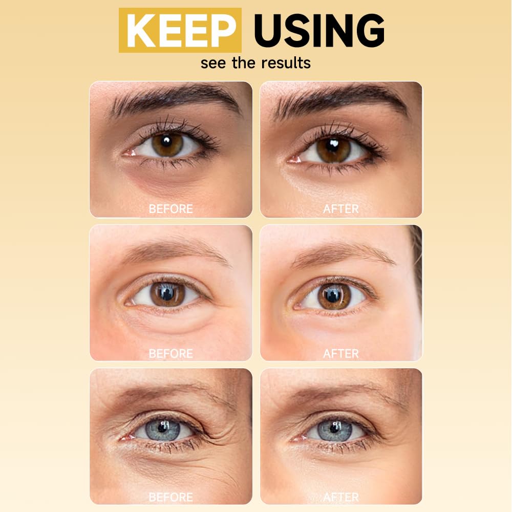 Natener patches in nighttime skincare setting suggesting restorative use
