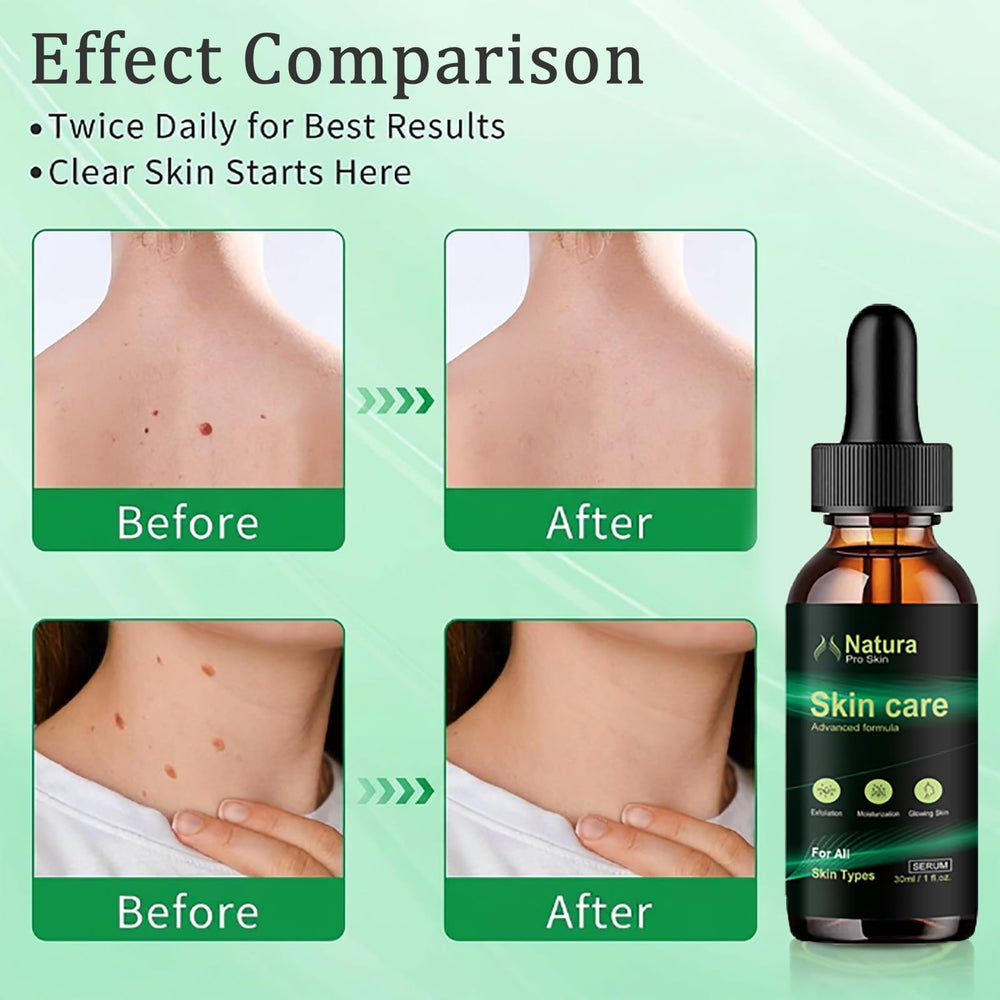 Natura Pro used under the arm to calm and moisturize delicate skin