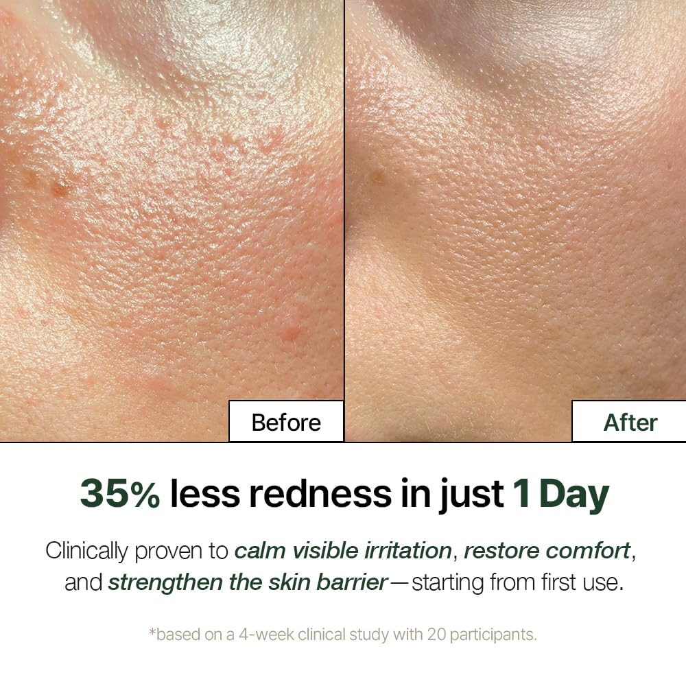 NATURAL DERMA PROJECT close-up of label highlighting centella and placenta actives for soothing