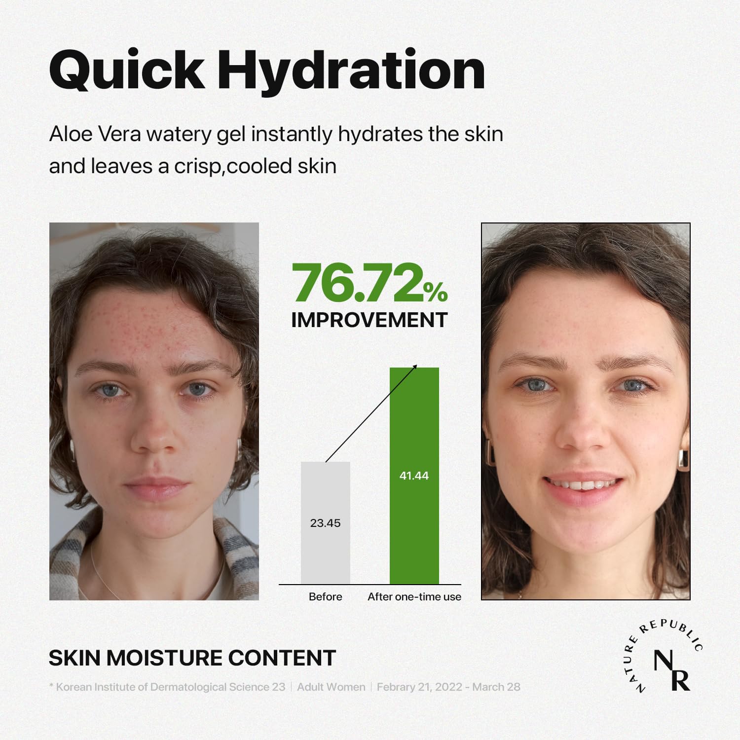 Nature Republic aloe vera gel used after sun to soothe and cool skin