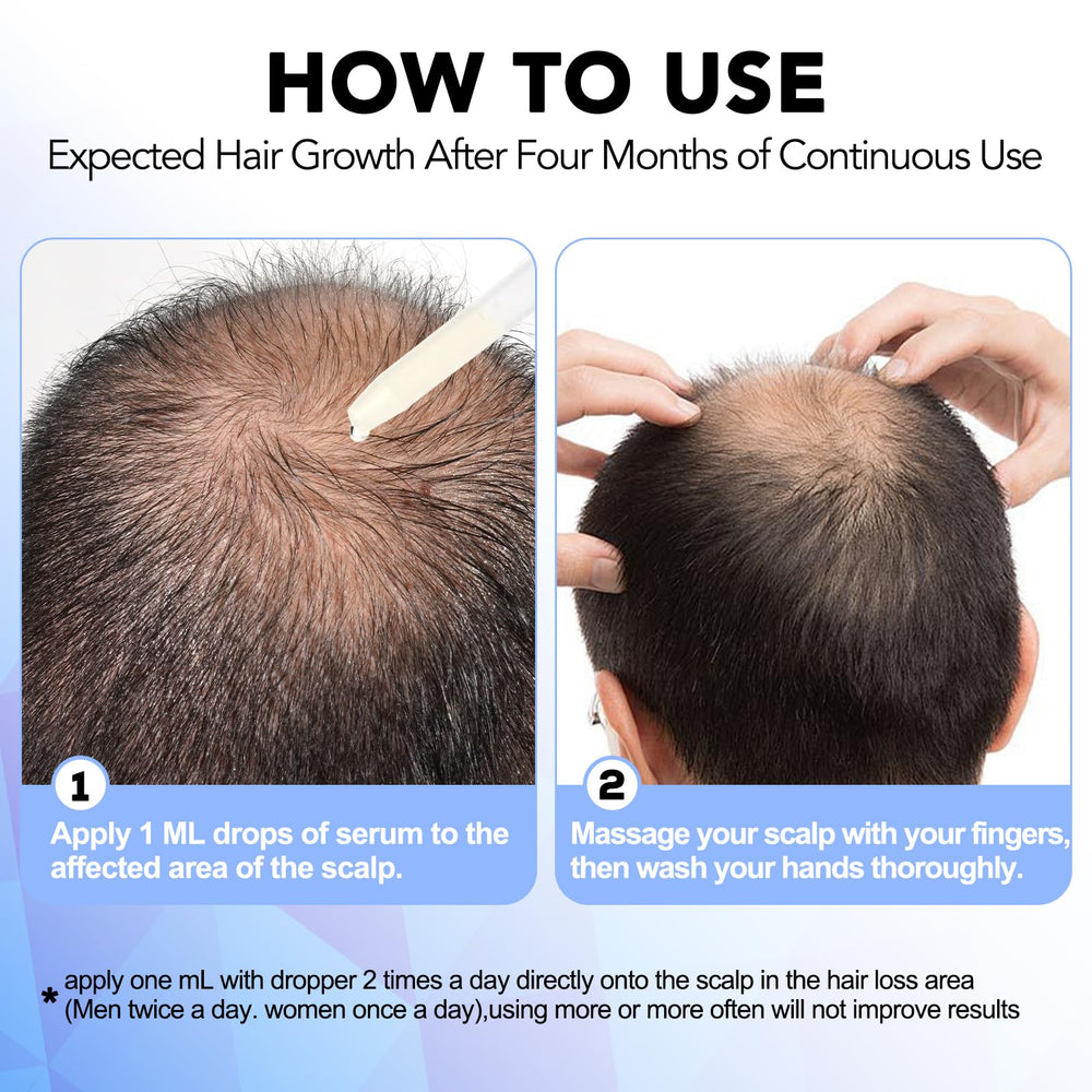 NATURE ZIRAN used on beard area showing improved density potential