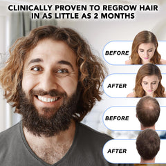 NATURE ZIRAN applied to scalp demonstrating targeted treatment benefit