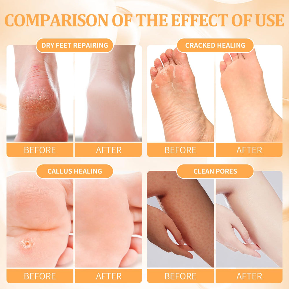 nbc BeautiLab bubble salt dissolving in foot basin creating foamy soak for refreshed feet