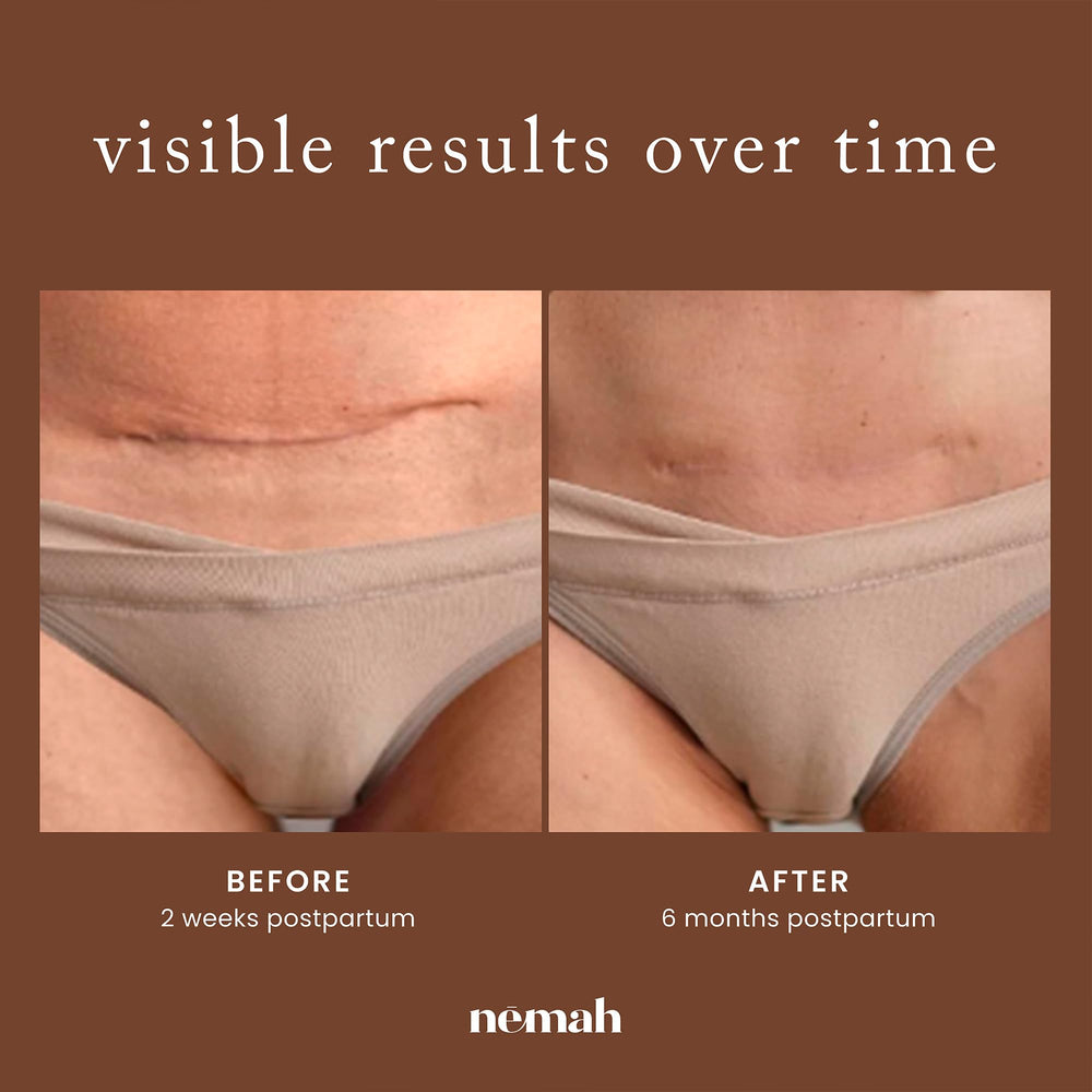 Nemah cream texture swiped on skin demonstrating fast absorption