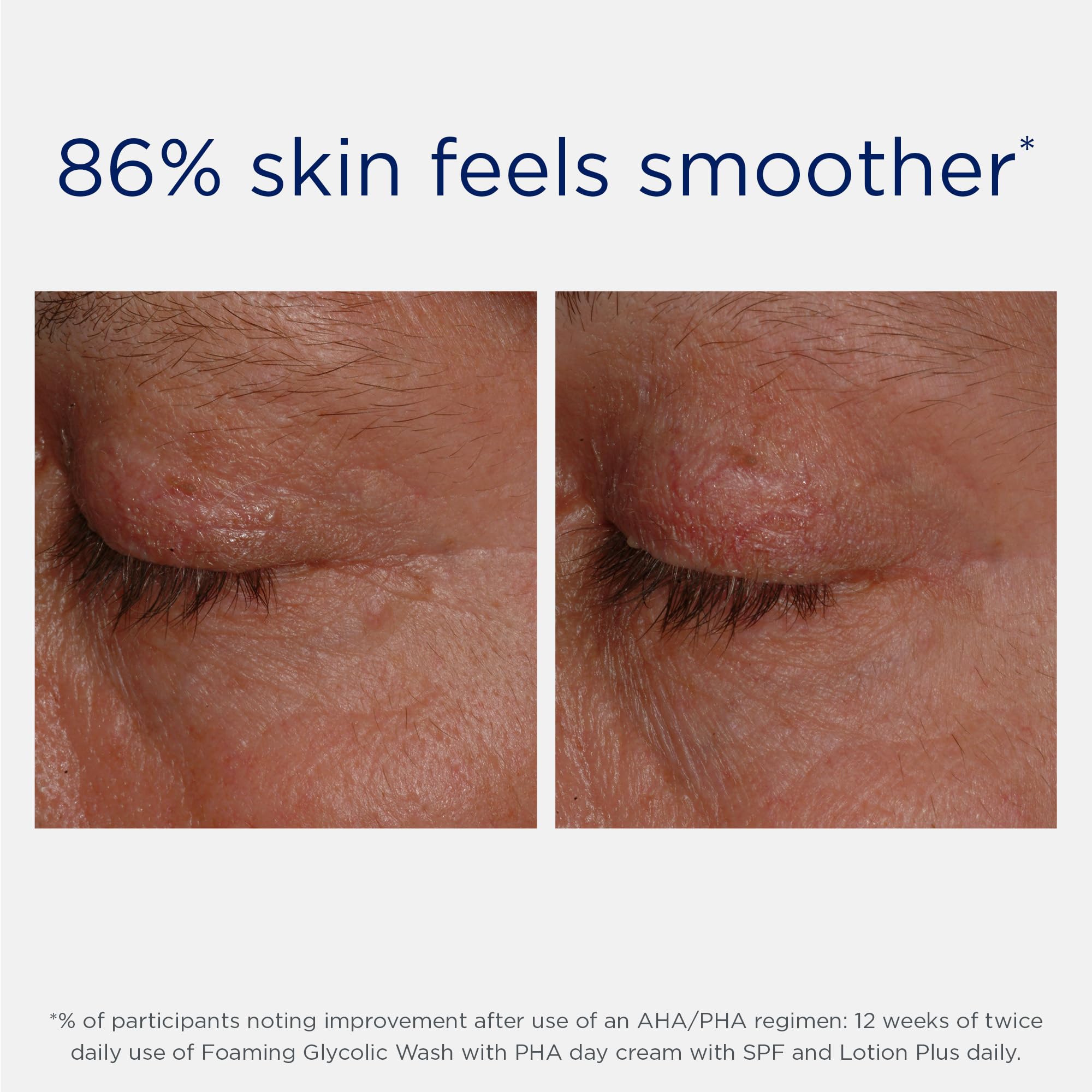 NEOSTRATA ingredient visual emphasizing active acid delivery