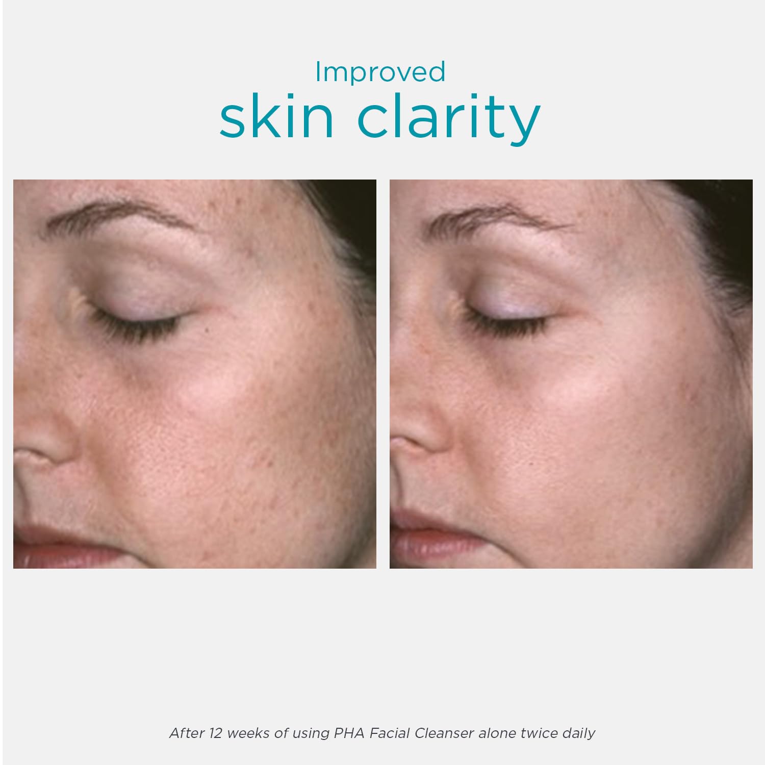 NEOSTRATA gel texture on hand demonstrating smooth spreadability benefit