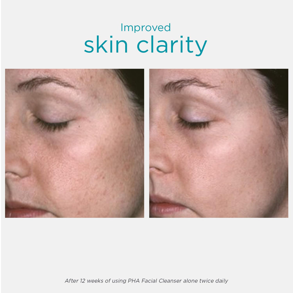 NEOSTRATA gel texture on hand demonstrating smooth spreadability benefit