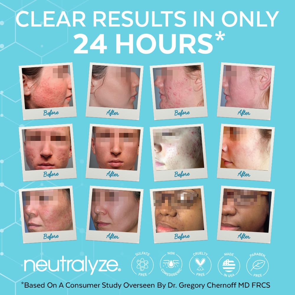 Neutralyze bottle in hand showing 5 fl oz scale for informed sizing