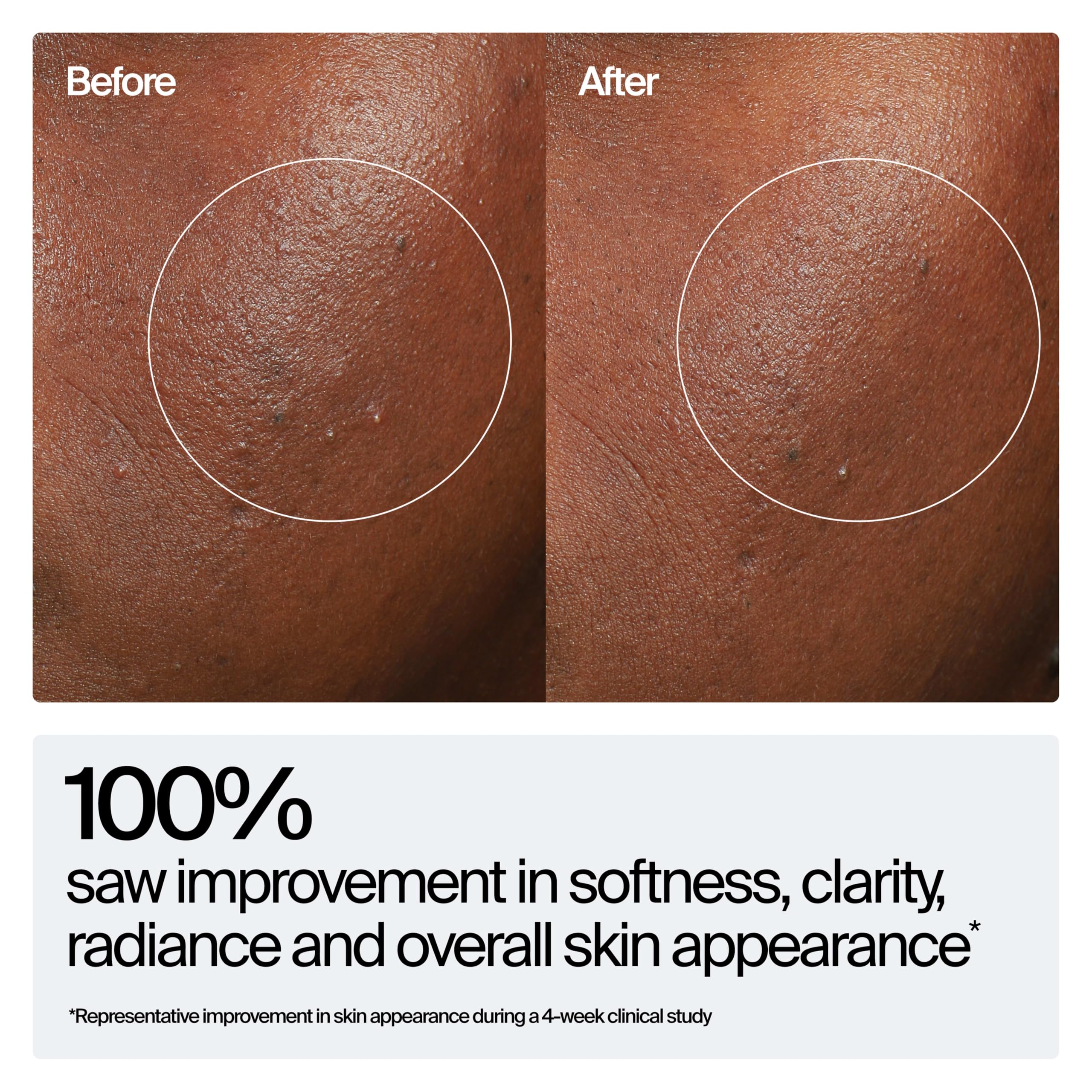 Neutrogena serum on hand illustrating quick absorption and non-greasy finish