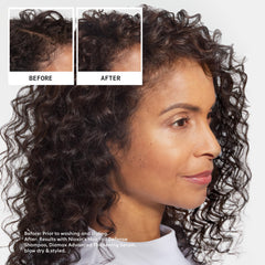 NIOXIN ingredients label highlighting niacinamide and caffeine benefits