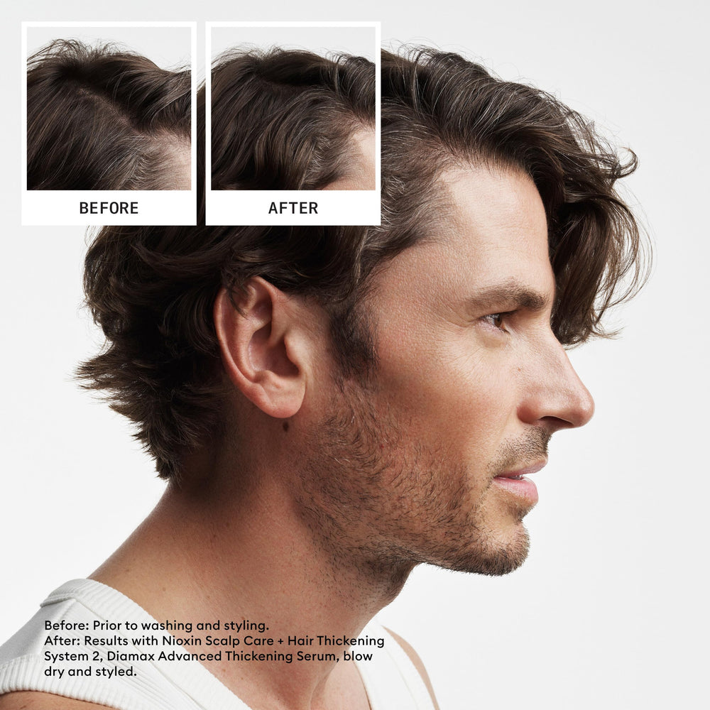 NIOXIN shampoo gel texture on palm, demonstrates cleansing power and residue removal