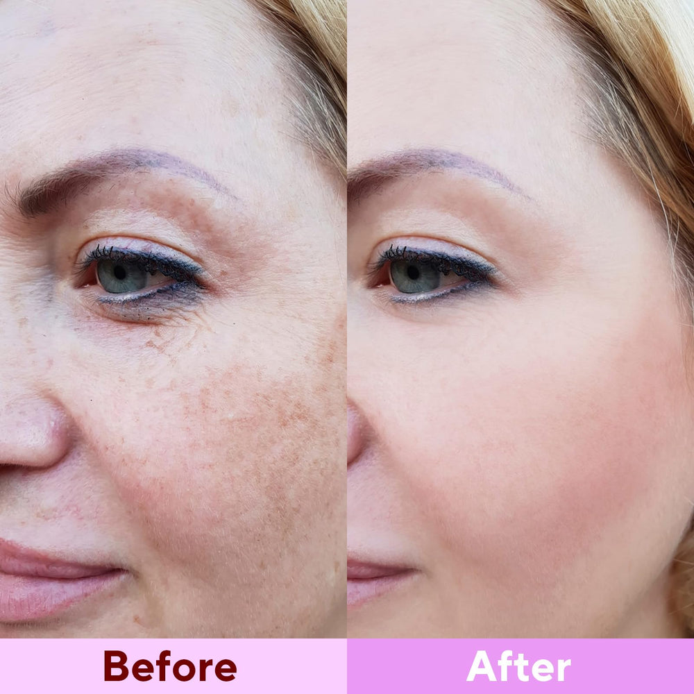Nityrliv mask adhesion side profile illustrating snug facial fit and seal