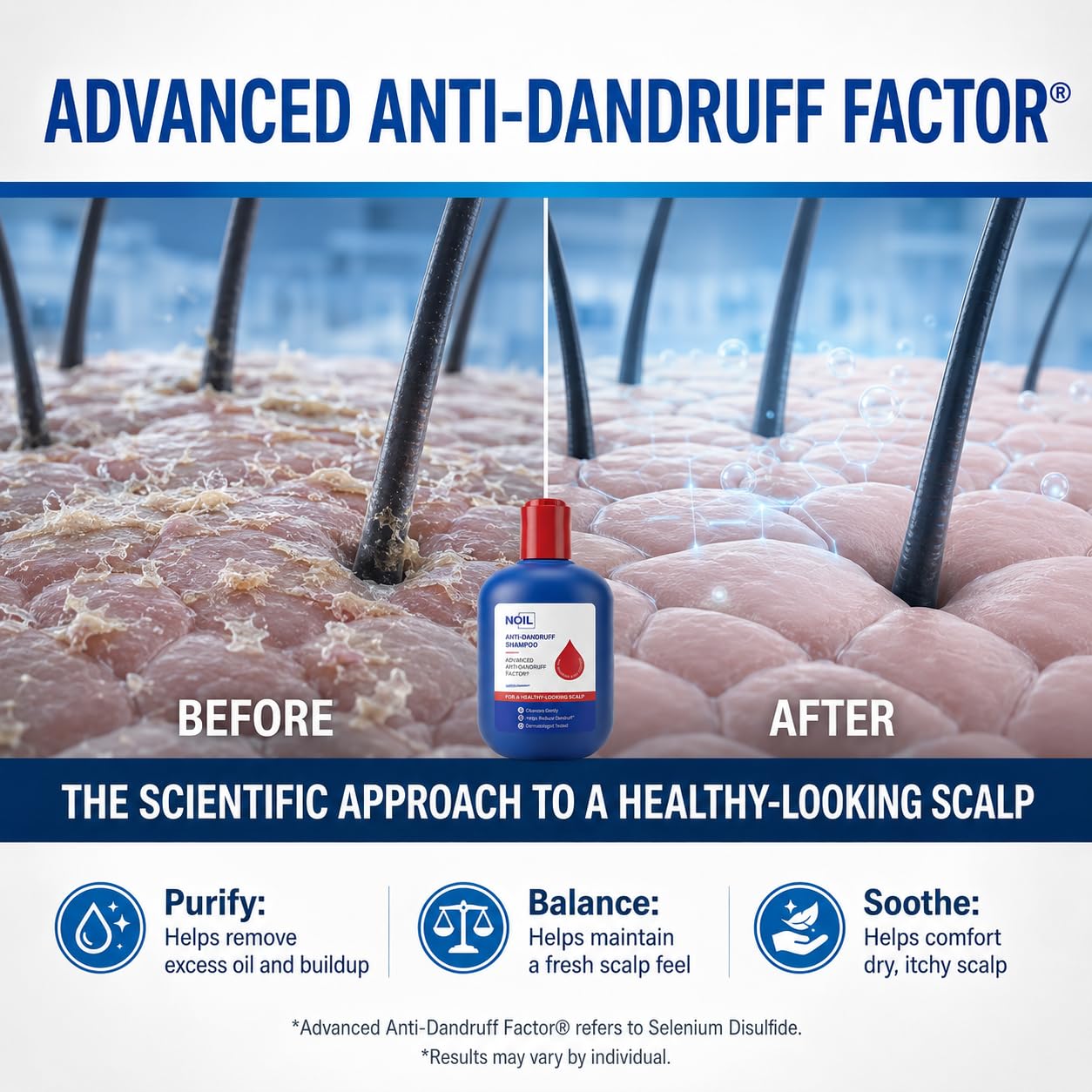 NOIL pouring into hand to demonstrate easy dispensing and control benefit