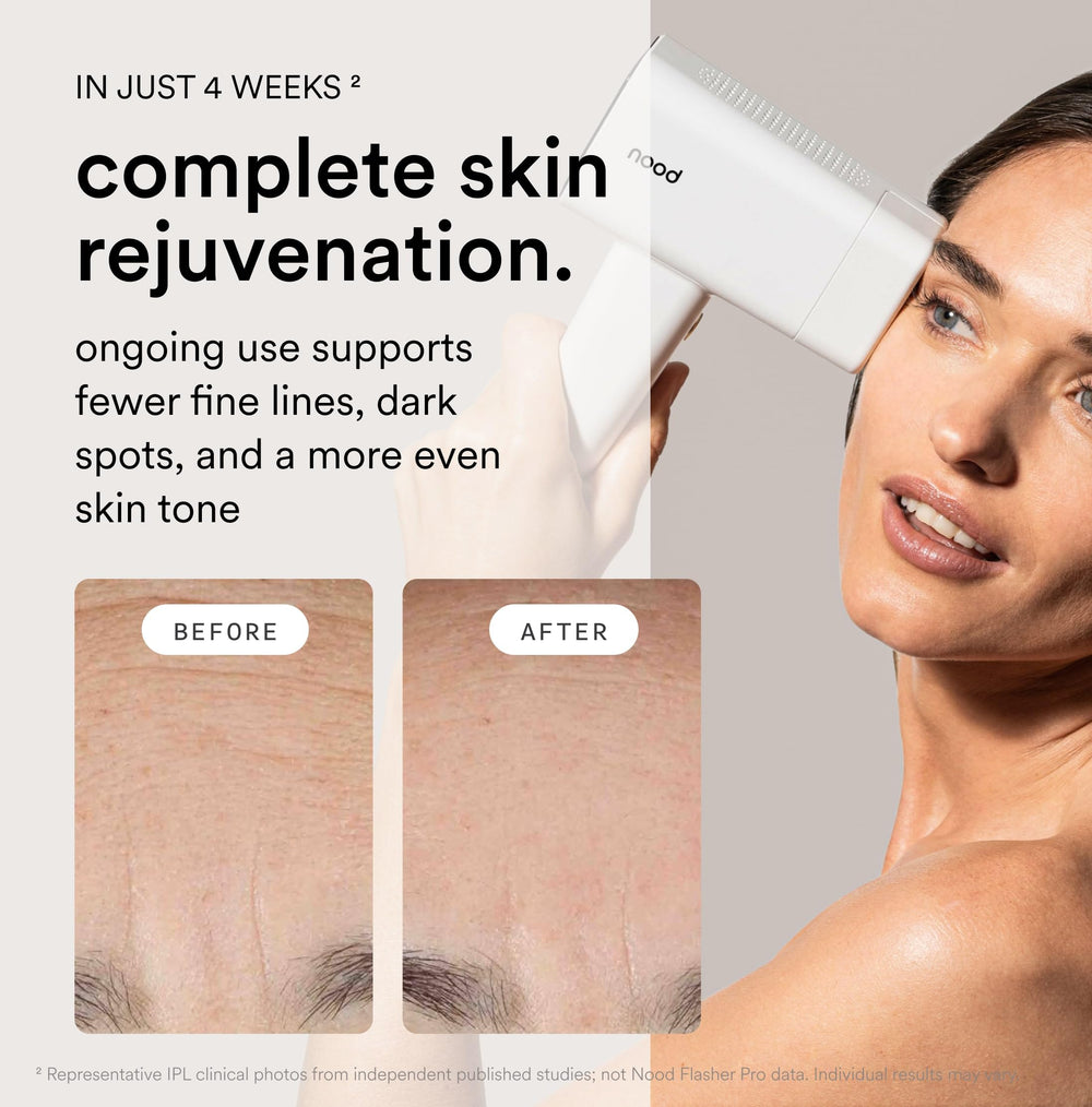 Detail of Nood Ageless Lens attachment highlighting anti-aging option for skin tone improvement
