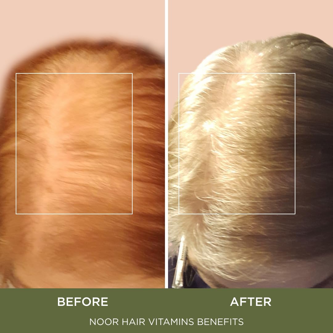 NOOR HAIR ingredient label detail showing vitamins and mineral list