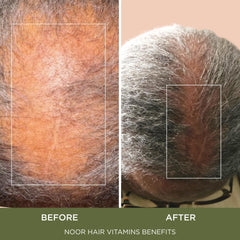 NOOR HAIR lifestyle image woman taking capsule supporting daily routine