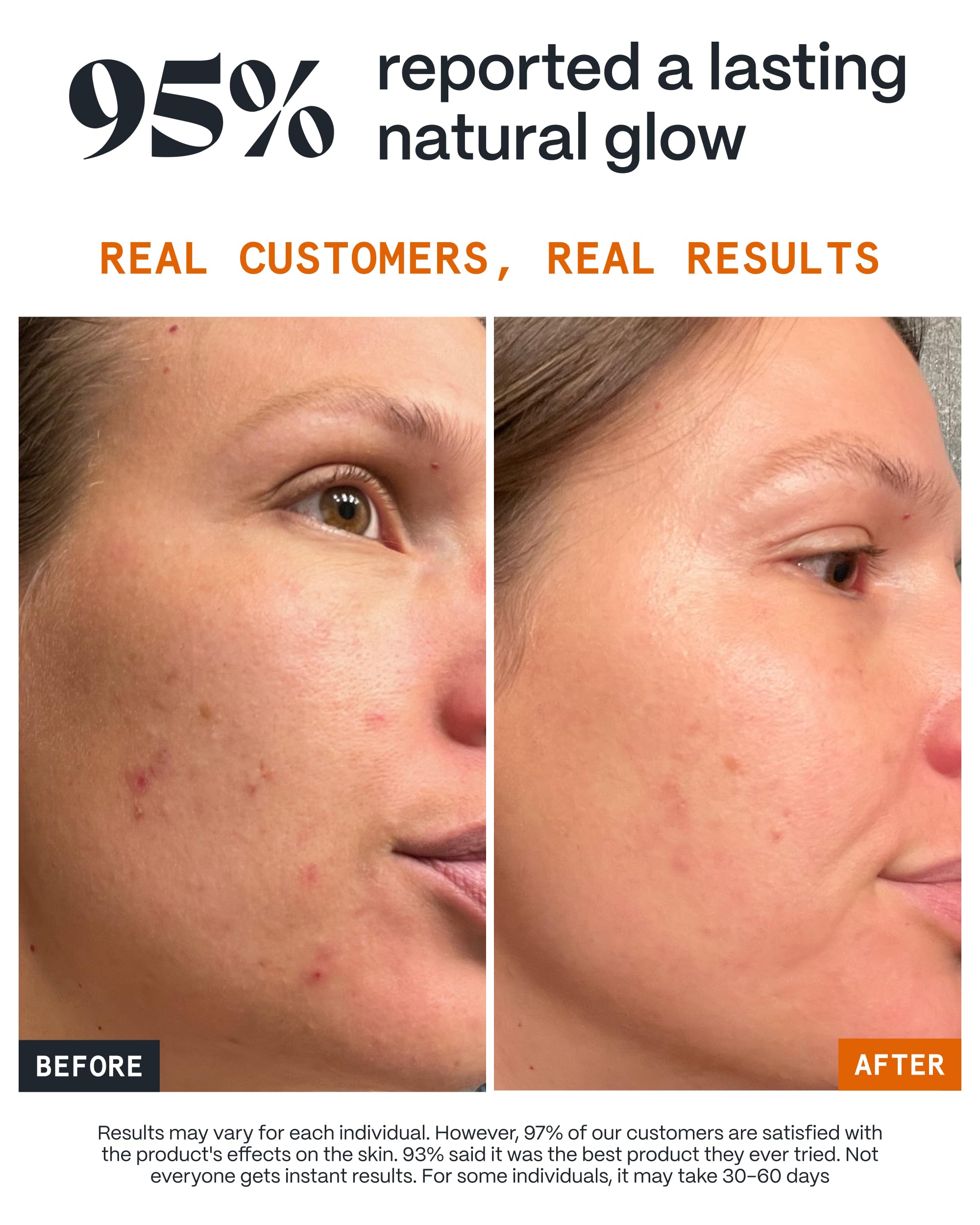 Norse Organics balm on face before and after showing reduced redness