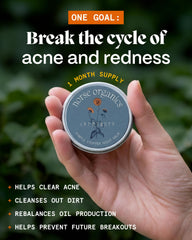 Norse Organics rosehip and sea buckthorn botanicals showing natural calming benefits