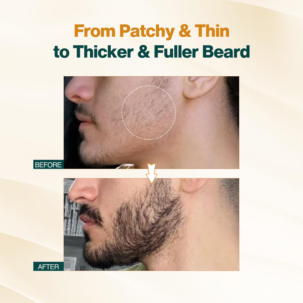 NOURISH MANTRA before and after beard density comparison illustrating fuller look