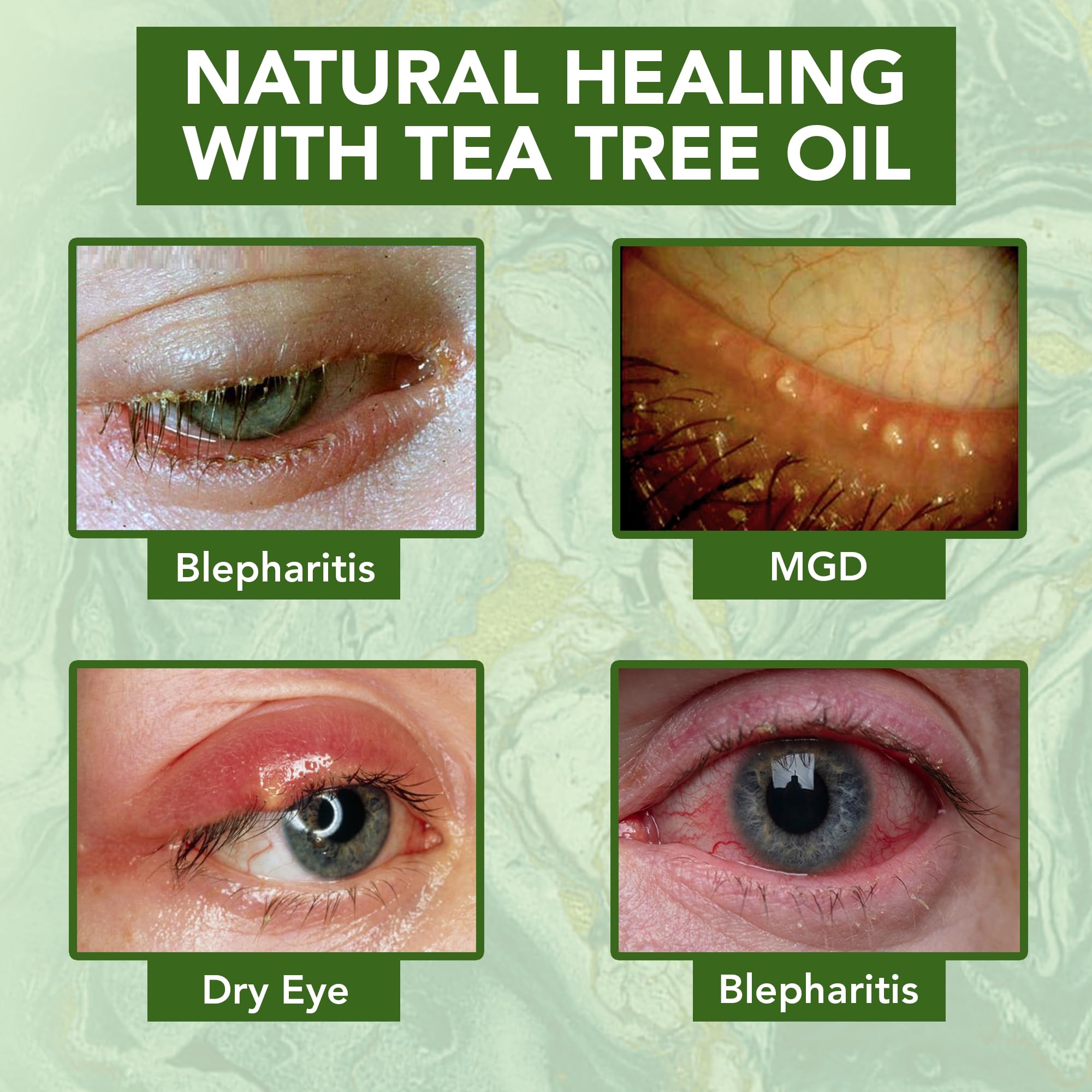 NOVEHA applying cream to eyelid demonstrating gentle hydration benefit