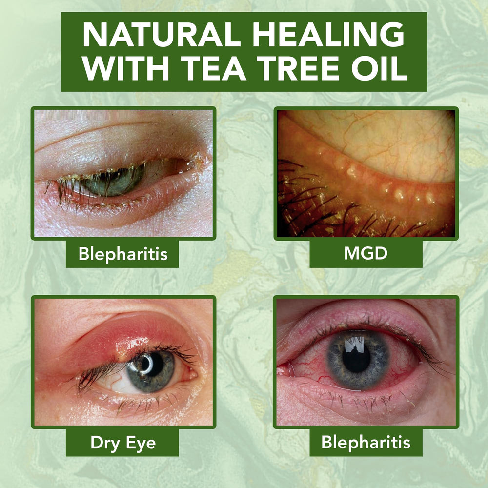 NOVEHA applying cream to eyelid demonstrating gentle hydration benefit