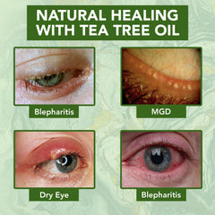NOVEHA applying cream to eyelid demonstrating gentle hydration benefit