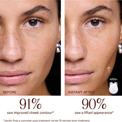 Close-up of NuFACE MINI+ device head highlighting smooth treatment electrodes for comfort