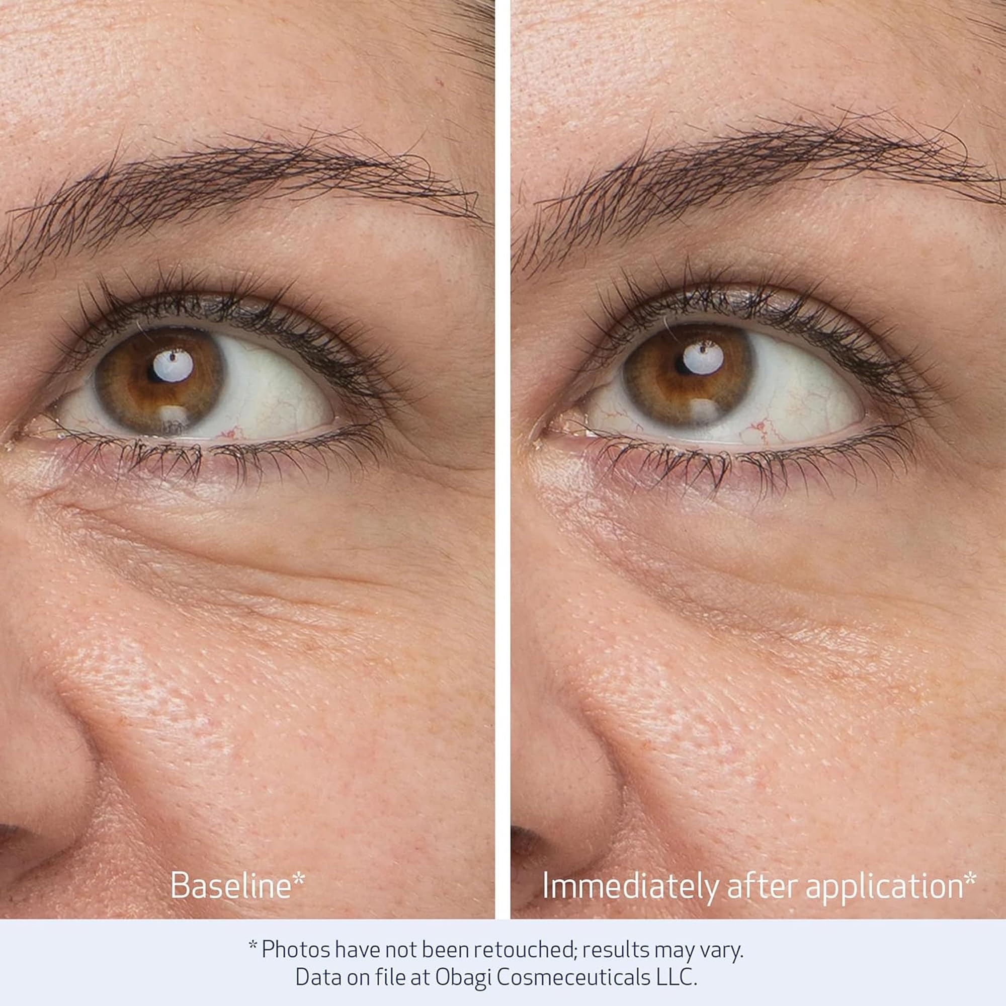 Obagi Medical applicator smoothing under-eye for instant de-puffing benefit