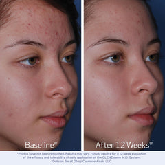 Obagi Medical CLENZIderm M.D. clear liquid texture pouring to show lightweight exfoliating feel benefit