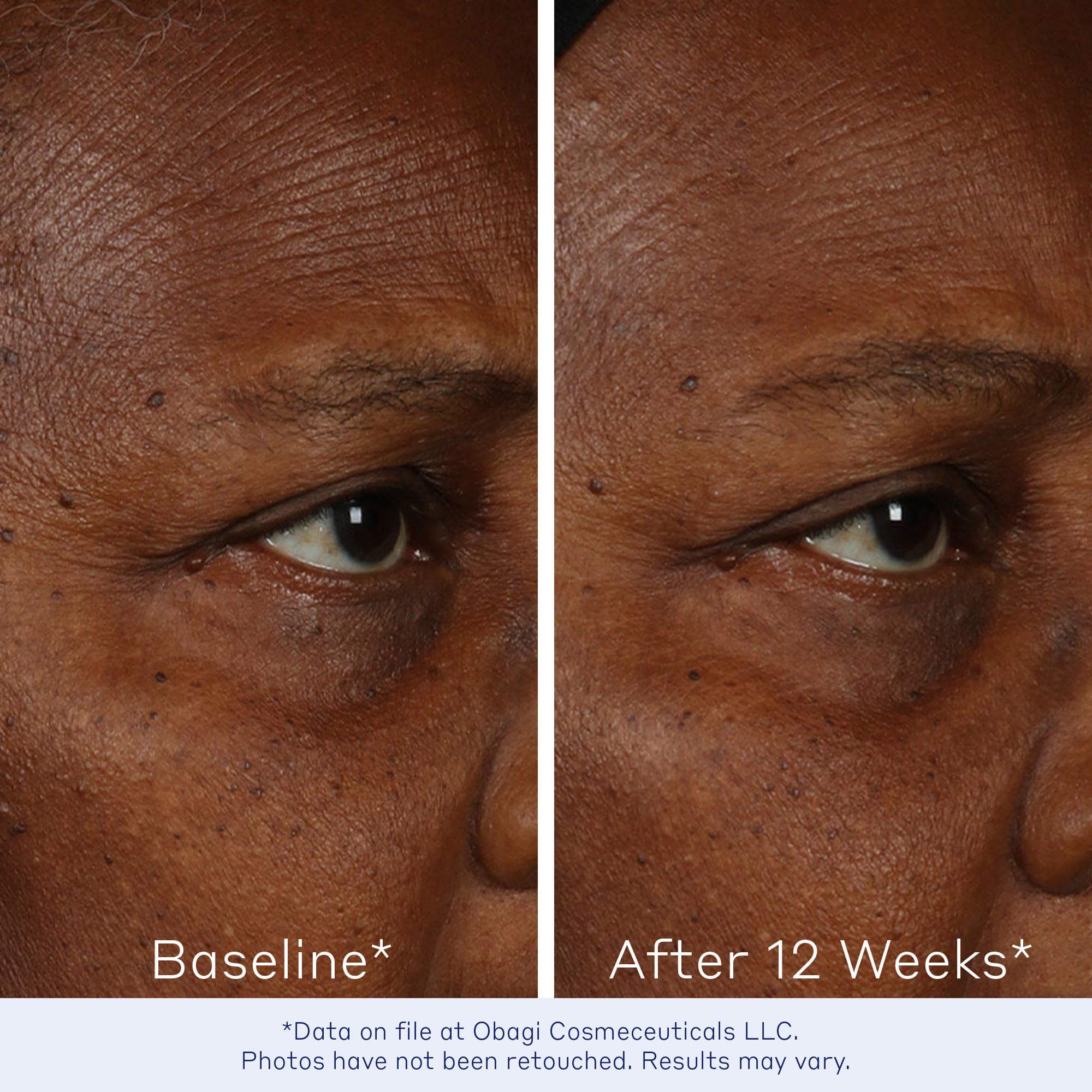 Obagi Medical label close-up displaying Bi-Mineral Contour Complex information