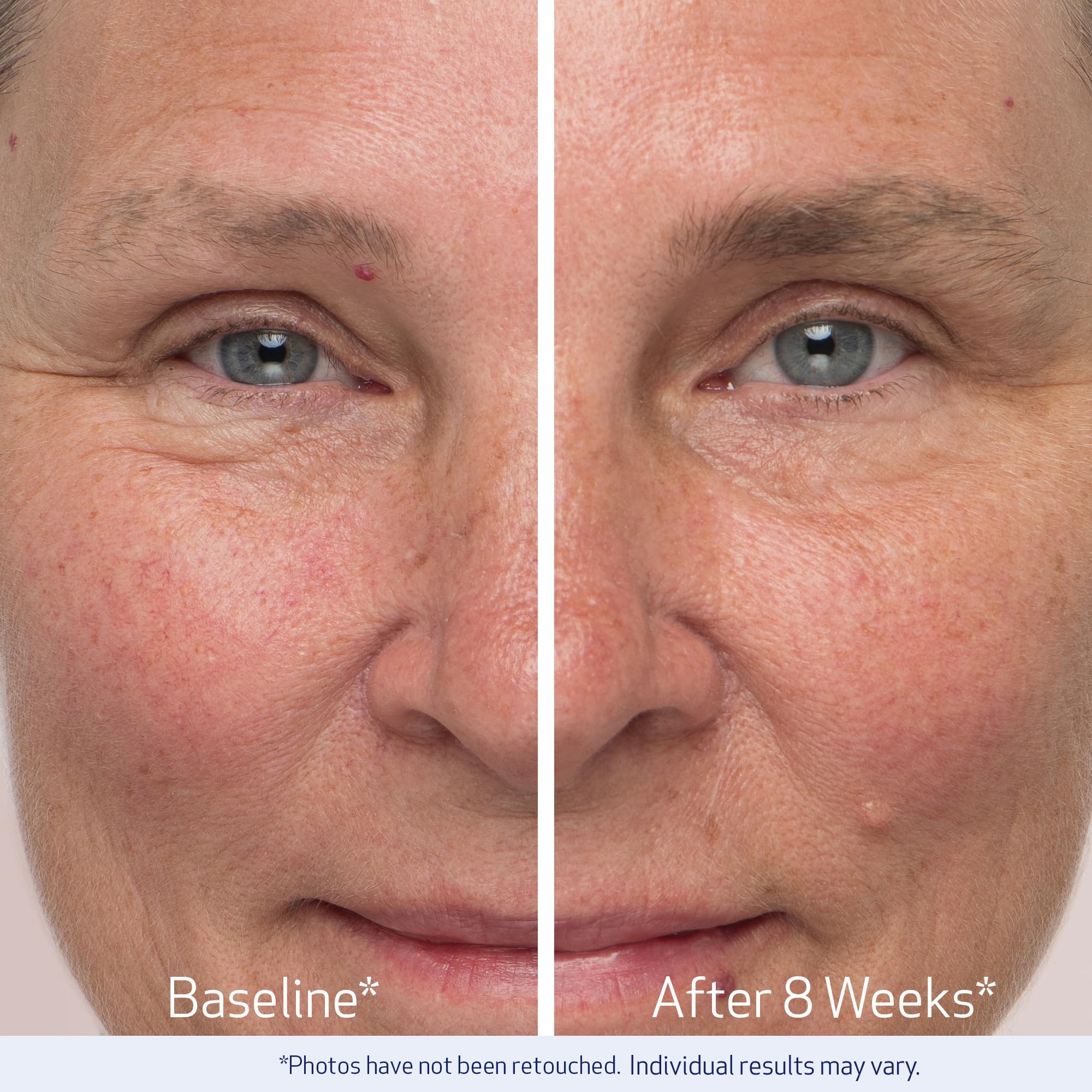 Obagi Nu-Cil applied along eyebrow with applicator, neat daily routine demonstrated