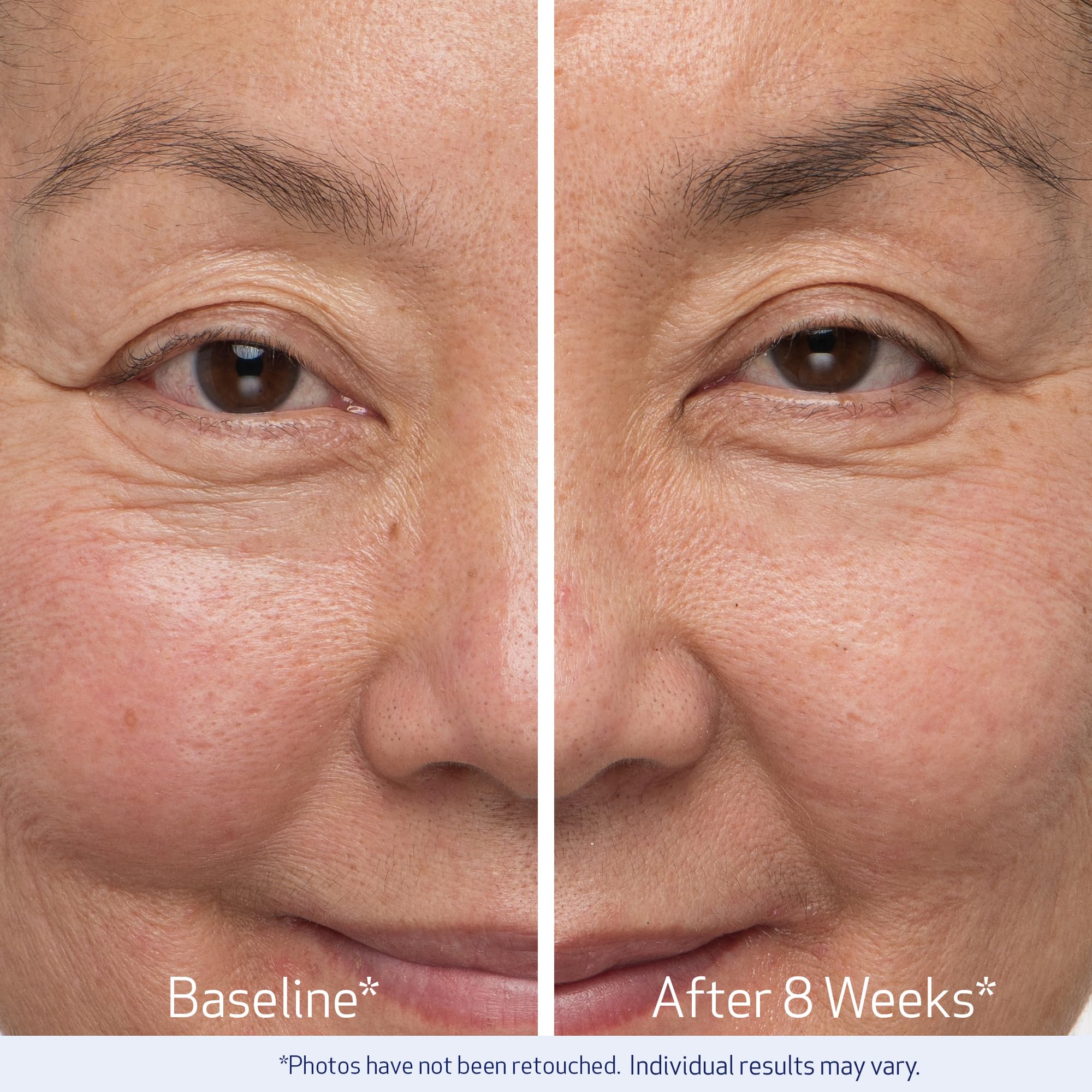 Obagi Nu-Cil before and after illustration showing improved brow fill visually