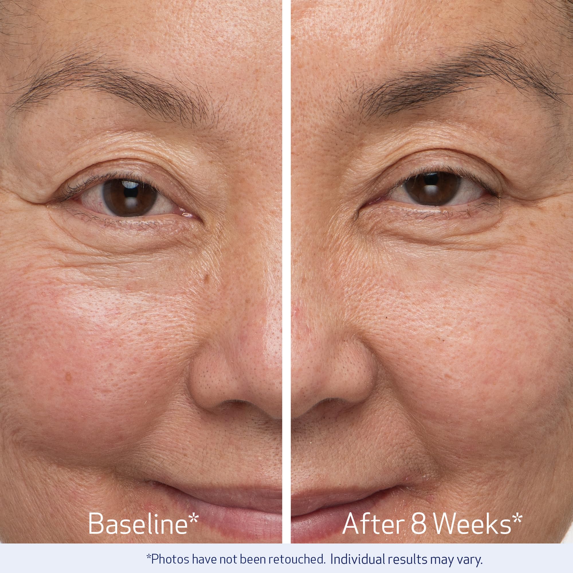 Obagi Nu-Cil eyelash applied on model demonstrating fuller-looking lashes