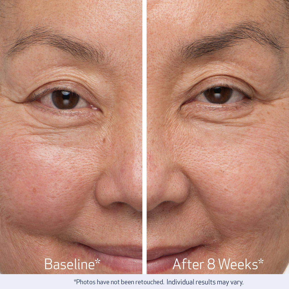 Obagi Nu-Cil eyelash applied on model demonstrating fuller-looking lashes