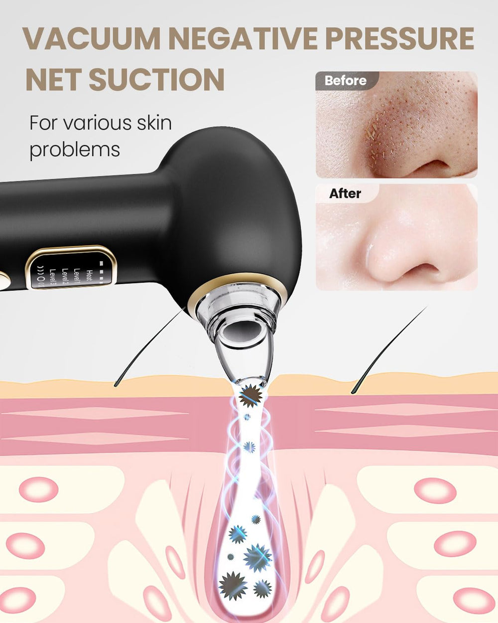 OIRIBO in use on nose area illustrating precise blackhead removal benefit