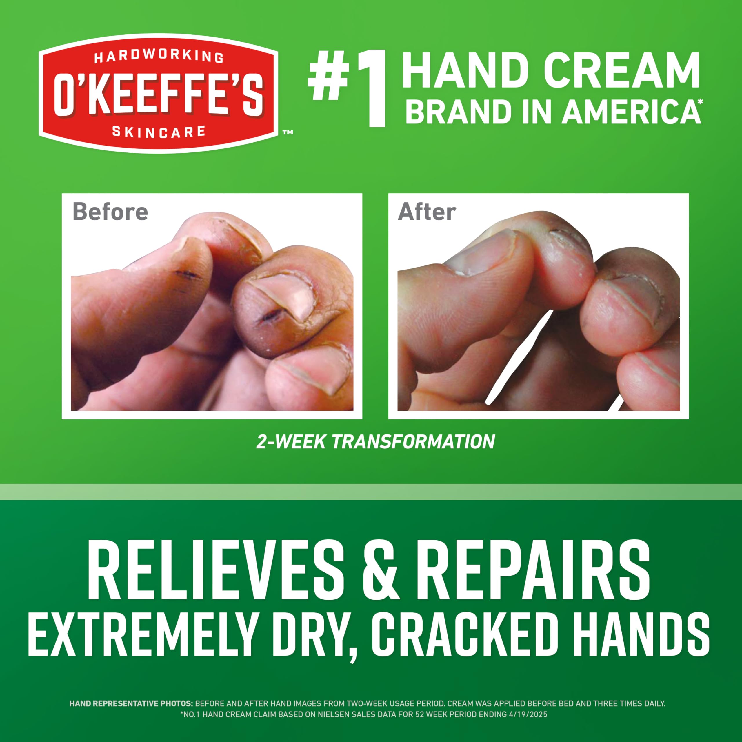 O'Keeffe's open tube with cream visible offering quick relief