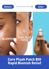 OLIVE YOUNG close-up of thin hydrocolloid patch texture, clear coverage benefit