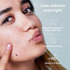OMMA microdart patch applied on cheek in use protecting and treating a blemish