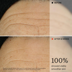 OneSkin used on neck and décolletage illustrating strengthened delicate skin benefit
