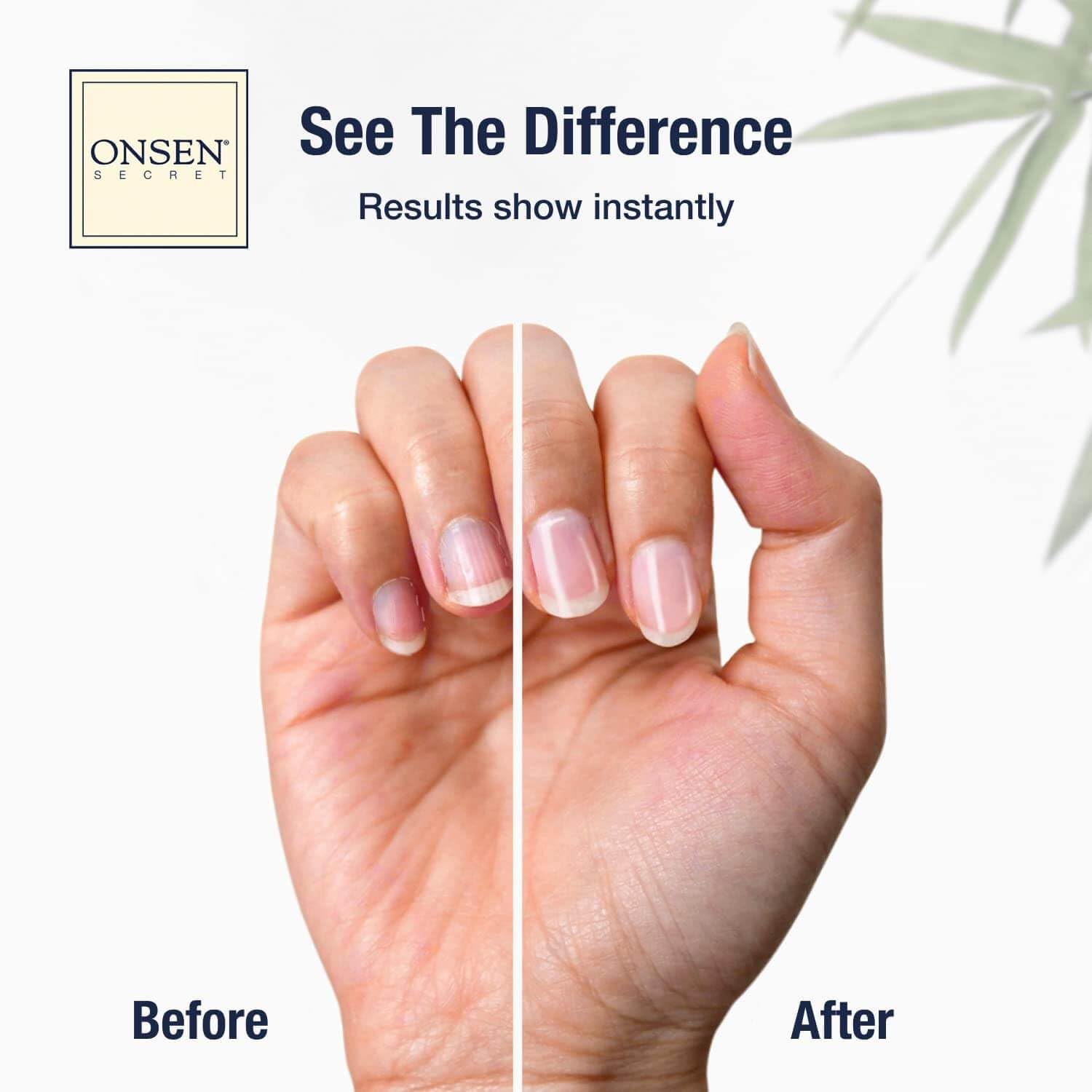 ONSEN cuticle serum dropper bottle demonstrating precise application benefit