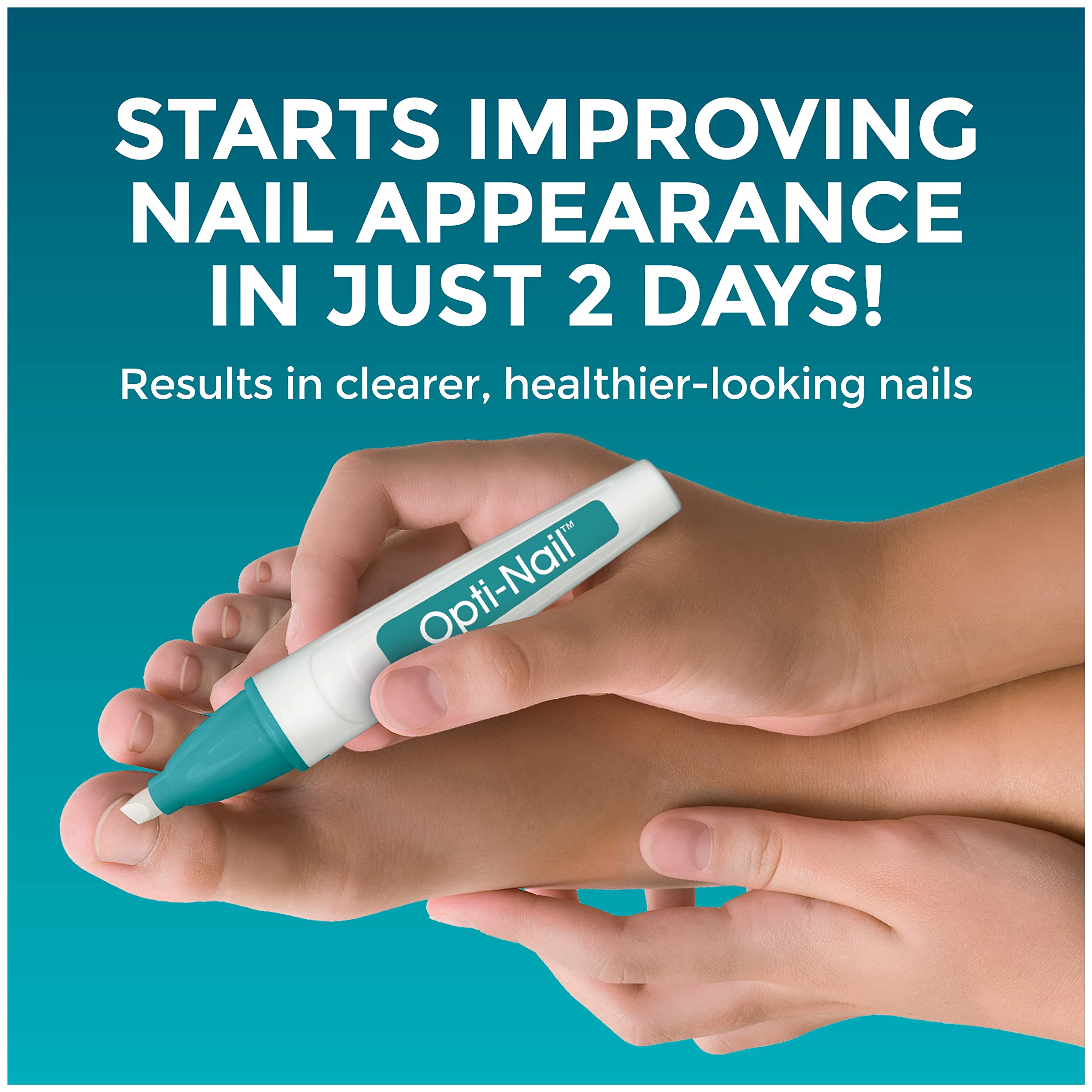 Opti-Nail being applied to a toenail demonstrating targeted use