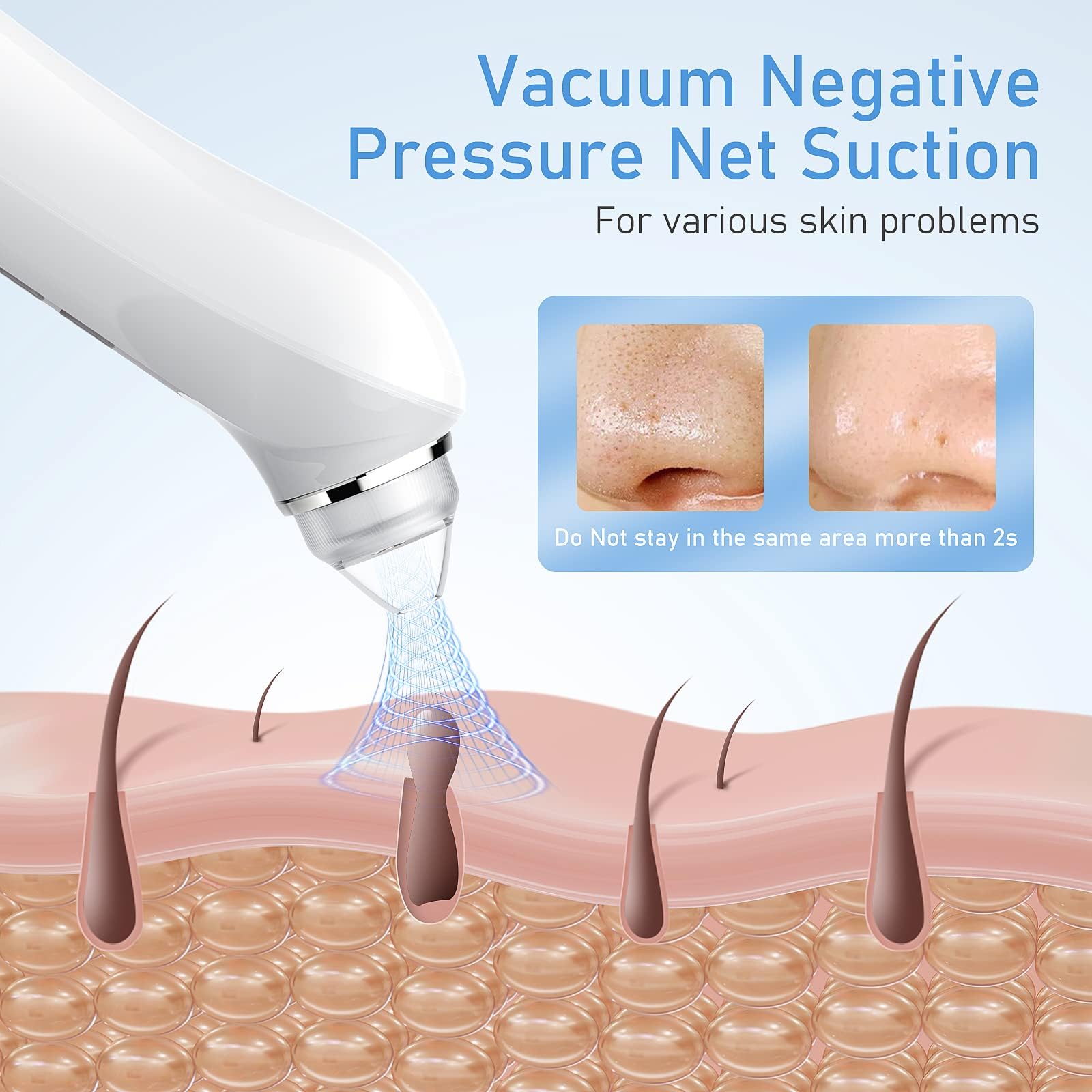 Ottleba six replaceable heads displayed to show versatility and targeted treatment options