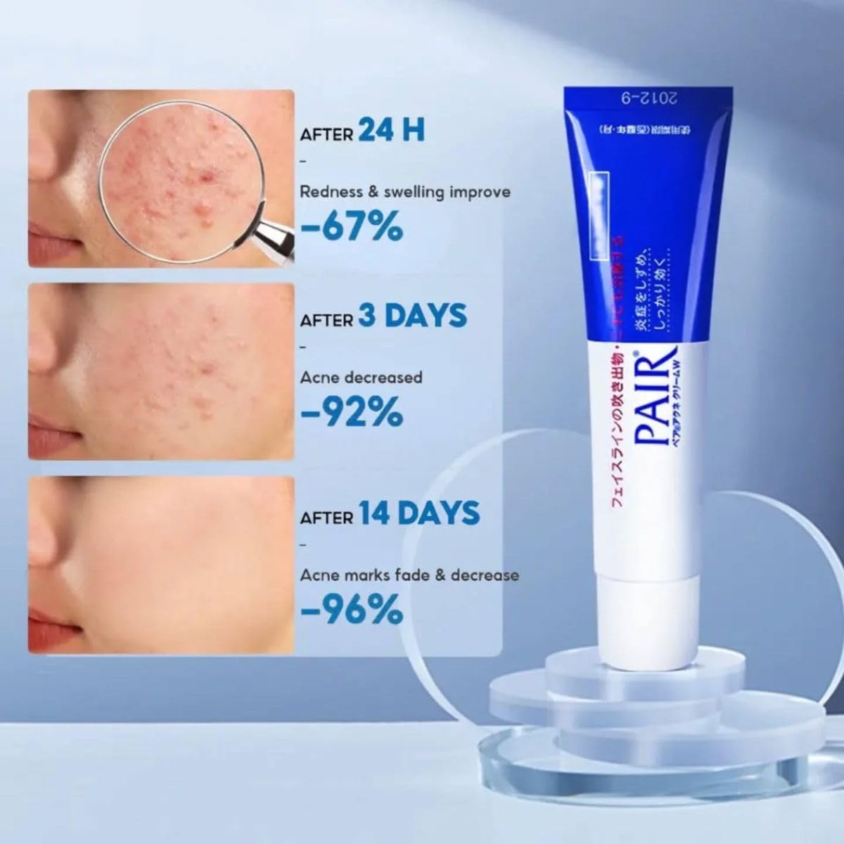 PAIR acne cream on bathroom shelf lifestyle shot showing daily routine convenience