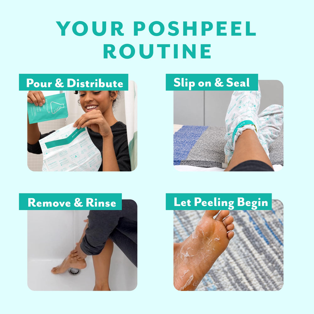 Patchology peeled skin results showing softer feet after treatment