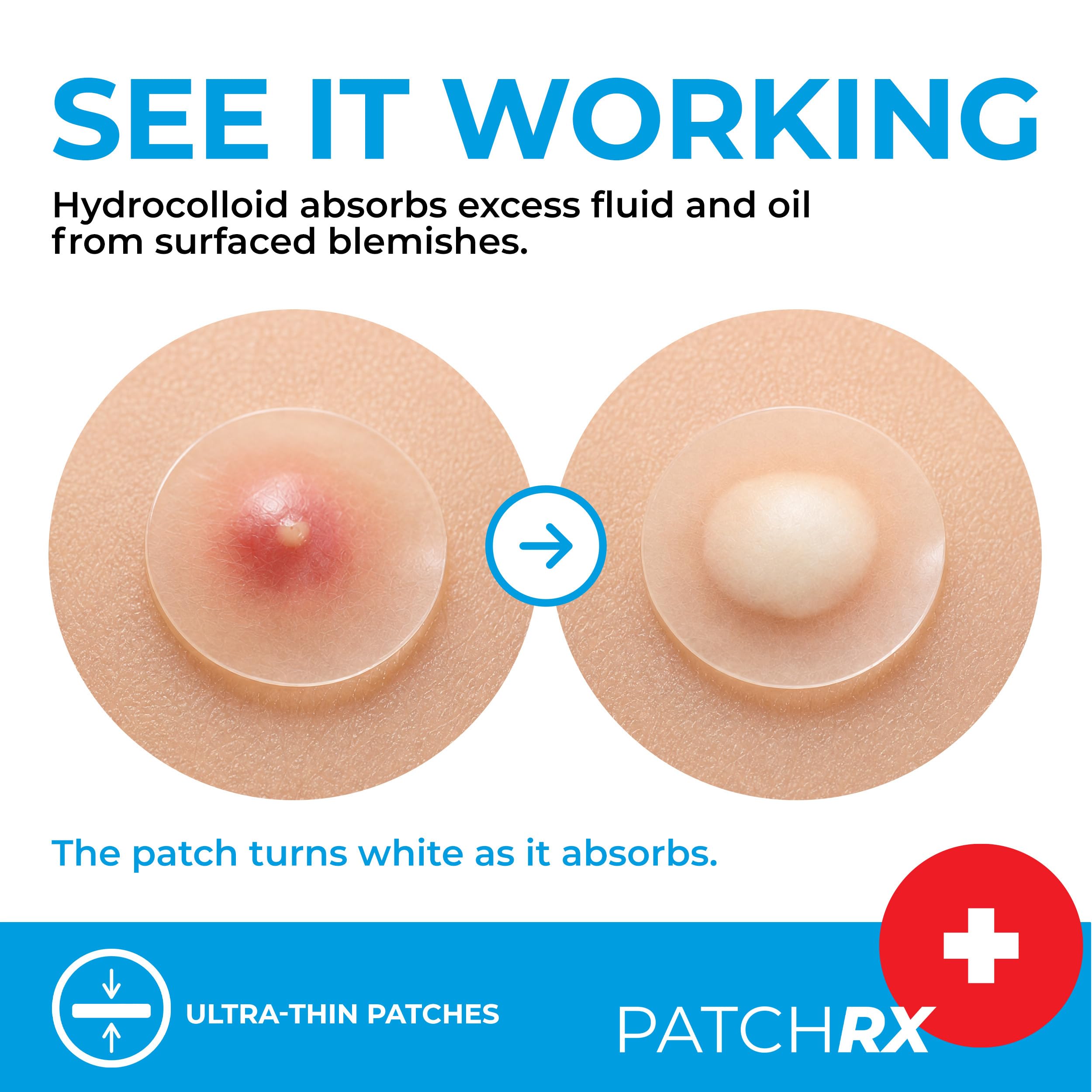 PatchRx sheet close-up displaying dot shapes and easy-peel backing for precise placement